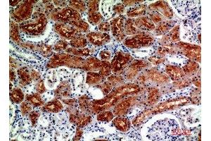 Immunohistochemical analysis of paraffin-embedded human-kidney, antibody was diluted at 1:200