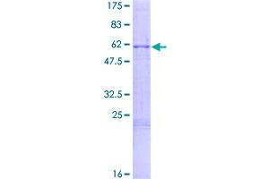 Image no. 1 for Proopiomelanocortin (POMC) (AA 1-267) protein (GST tag) (ABIN1315729)