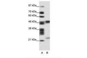 Image no. 1 for anti-PHD Finger Protein 11 (PHF11) (AA 171-220) antibody (ABIN6736092) (PHF11 anticorps  (AA 171-220))