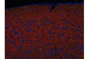 Indirect immunostaining of PFA fixed paraffin embedded mouse cortex section with anti-Homer 1/2/3 (dilution 1 : 500; red) and mouse anti-SERT (green). (Homer 1/2/3 (N-Term) anticorps)