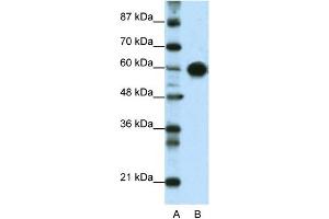 WB Suggested Anti-ZSCAN5 Antibody Titration:  0. (ZSCAN5A anticorps  (Middle Region))