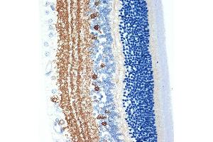 anti-Cellular Retinoic Acid Binding Protein 1 (CRABP1) antibody