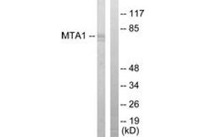 Western blot analysis of extracts from Jurkat cells, using MTA1 Antibody.