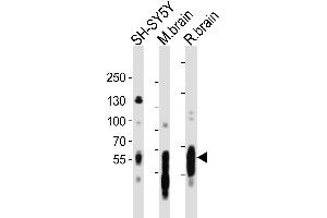 Western blot analysis of lysates from SH-SY5Y cell line, mouse brain, rat brain tissue lysate(from left to right), using PT Antibody (C-term) (ABIN6243259 and ABIN6577758). (MAPT anticorps  (C-Term))