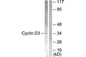Western blot analysis of extracts from COS7 cells, treated with Forskolin 40nM 30', using Cyclin D3 (Ab-283) Antibody.