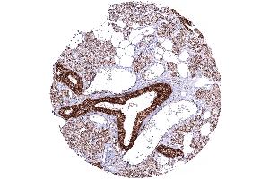 Parotis with intense cytoplasmic ATP5J staining in excretory ducts while tbe staining is markedly weaker in other cell types