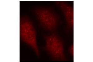 Immunofluorescence staining of methanol-fixed Hela cells using Phospho-CDK6-Y24 antibody.