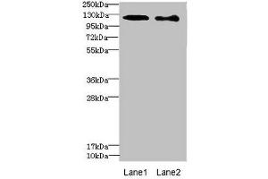 Western blot All lanes: DIAPH2 antibody at 4.
