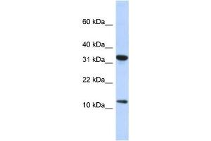 Western Blotting (WB) image for anti-Basic Transcription Factor 3 Pseudogene 11 (BTF3P11) antibody (ABIN2458156) (BTF3P11 anticorps)