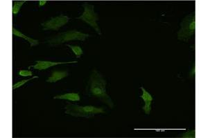 Immunofluorescence of monoclonal antibody to HHEX on HeLa cell. (HHEX anticorps  (AA 133-237))