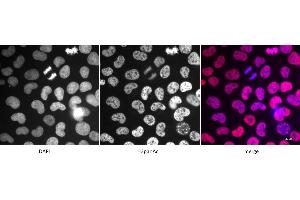 Detection of H3panAc by immunofluorescence. (Histone 3 anticorps  (acLys))