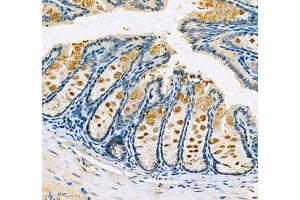 Immunohistochemistry of paraffin embedded mouse colon using Znt1 (ABIN7075672) at dilution of 1:650 (300x lens)