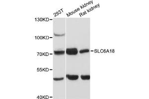 Western blot analysis of extracts of various cell lines, using SLC6A18 antibody (ABIN6290962) at 1:3000 dilution. (SLC6A18 anticorps)