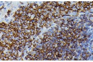 Immunohistochemistry of paraffin-embedded Rat spleen using APOC3 Polyclonal Antibody at dilution of 1:100 (40x lens).
