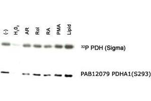 Western blot analysis of PDHA1 in an in vitro autophosphorylation of PDH complex in response to different stimulants with PDHA1 (phospho S293) polyclonal antibody . (PDHA1 anticorps  (pSer293))