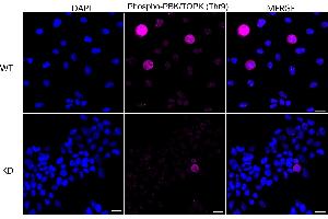 Immunocytochemical staining of HeLa cells using Phospho-PBK/TOPK (Thr9) antibody (ABIN7799752), 1:1,000), Top panel: wild-type (WT), Bottom panal: Phospho-PBK/TOPK (Thr9) shRNA knockdown (KD). (Recombinant PBK anticorps  (pThr9))