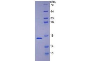 SDS-PAGE analysis of Human BMP6 Protein. (BMP6 Protéine)