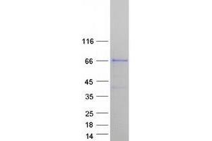 Validation with Western Blot