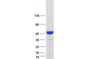 Validation with Western Blot