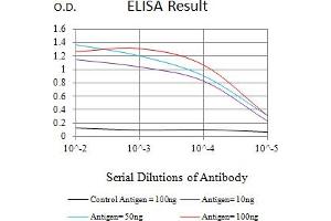 Black line: Control Antigen (100 ng),Purple line: Antigen (10 ng), Blue line: Antigen (50 ng), Red line:Antigen (100 ng) (CKM anticorps  (AA 1-381))