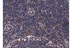 ABIN6266697 at 1/100 staining human lymph node tissue sections by IHC-P. (PDZD2 anticorps  (N-Term))