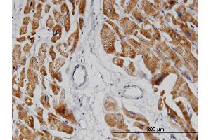 Immunoperoxidase of monoclonal antibody to NDUFA8 on formalin-fixed paraffin-embedded human heart.