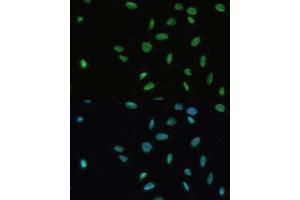 Immunofluorescence analysis of U-2 OS cells using SET/T antibody (ABIN6131353, ABIN6147631, ABIN6147634 and ABIN6221803) at dilution of 1:100.