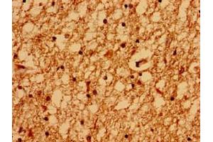 Immunohistochemistry of paraffin-embedded human brain tissue using ABIN7153987 at dilution of 1:100