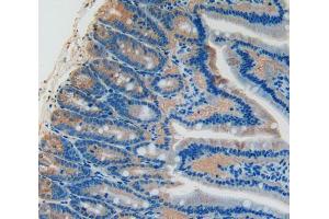 Used in DAB staining on fromalin fixed paraffin- embedded intestine tissue (PLAT anticorps  (AA 311-487))