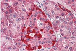 Human Pancreas (formalin-fixed, paraffin-embedded) stained with CASP1 antibody ABIN461892 at 5 ug/ml followed by biotinylated goat anti-rabbit IgG secondary antibody ABIN481713, alkaline phosphatase-streptavidin and chromogen. (Caspase 1 anticorps)