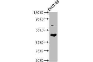 Western Blot Positive WB detected in: Colo320 whole cell lysate All lanes: GNAL antibody at 4.