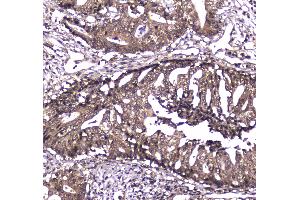 IHC analysis of Caspase 4 using anti-Caspase 4 antibody .