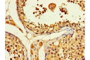 Immunohistochemistry of paraffin-embedded human testis tissue using ABIN7144946 at dilution of 1:100