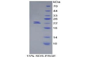 SDS-PAGE analysis of Mouse BMP1 Protein. (BMP1 Protéine)