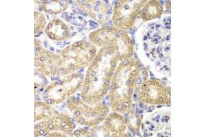 Immunohistochemistry of paraffin-embedded rat liver using HADH antibody (ABIN5970434) at dilution of 1/100 (40x lens). (HADH anticorps)