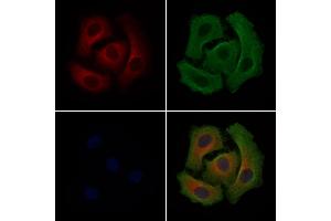 ABIN6265118 and ABIN6279217 staining Hela cells by IF/ICC. (slc25a13 anticorps  (C-Term))