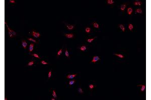 ABIN6266588 staining U-2 OS cells by IF/ICC. (MDM2 anticorps)