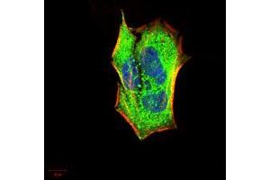 Immunofluorescence analysis of Hela cells using IRAK3 mouse mAb (green). (IRAK3 anticorps  (AA 454-596))