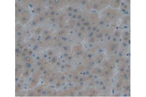 IHC-P analysis of Human Liver, with DAB staining. (Renin anticorps  (AA 67-179))