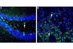 Expression of Homer1 in mouse hippocampus and striatum - Immunohistochemical staining of perfusion-fixed frozen mouse brain sections using Anti-Homer1 Antibody (ABIN7043273, ABIN7045168 and ABIN7045169), (1:400), followed by goat-anti-rabbit-AlexaFluor-488 secondary antibody.