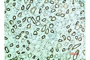Immunohistochemical analysis of paraffin-embedded human-kidney, antibody was diluted at 1:200