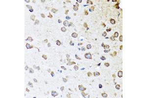 Immunohistochemistry of paraffin-embedded mouse brain using SERPINA10 antibody (ABIN5974273) at dilution of 1/100 (40x lens). (SERPINA10 anticorps)