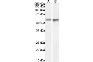 Western Blot using anti-BACE2 antibody 1/9 HeLa (A) and U251 (B) cell lysate samples (35 μg protein in RIPA buffer) were resolved on a 10 % SDS PAGE gel and blots probed with the chimeric mouse IgG1 version of 1/9 (ABIN7072331) at 1 μg/mL before detection using an anti-mouse secondary antibody. (Recombinant BACE2 anticorps)