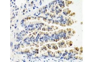 Immunohistochemistry of paraffin-embedded Mouse lung using NTF3 Polyclonal Antibody at dilution of 1:100 (40x lens).