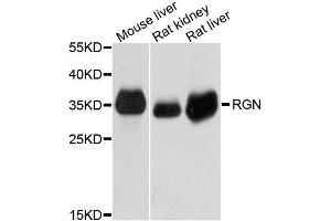 Western blot analysis of extracts of various cell lines, using RGN antibody. (Regucalcin anticorps  (AA 1-299))