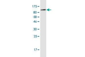 Western Blot detection against Immunogen (86. (GPI anticorps  (AA 1-558))