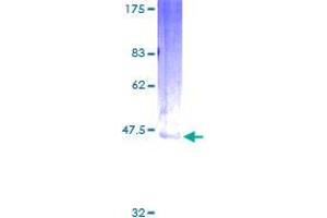 Image no. 1 for Endothelin 2 (EDN2) (AA 1-178) protein (GST tag) (ABIN1352326)
