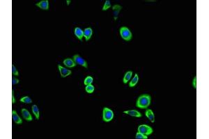 Immunofluorescent analysis of PC-3 cells using ABIN7148931 at dilution of 1:100 and Alexa Fluor 488-congugated AffiniPure Goat Anti-Rabbit IgG(H+L)