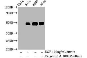 Western Blot  Positive WB detected in: Hela whole cell lysate, A549 whole cell lysate(treated with Calyculin A or EGF)  All lanes: Phospho-JUN antibody at 0. (Recombinant C-JUN anticorps  (pSer63))