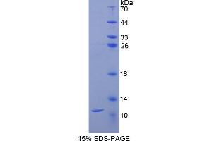 SDS-PAGE analysis of Rat CD3d Protein. (CD3D Protéine)